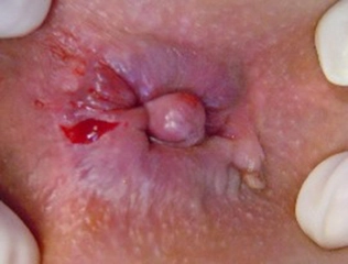 Makat Özellikleri ve Faydaları Nelerdir?